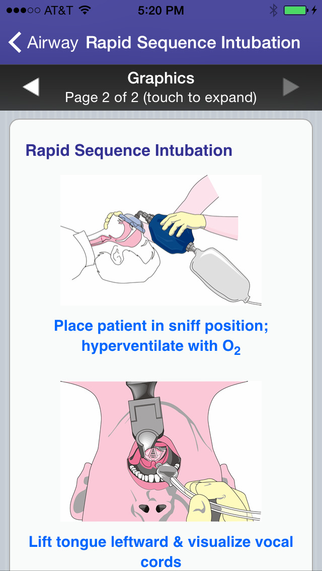 Critical Care ACLS Guideのおすすめ画像3