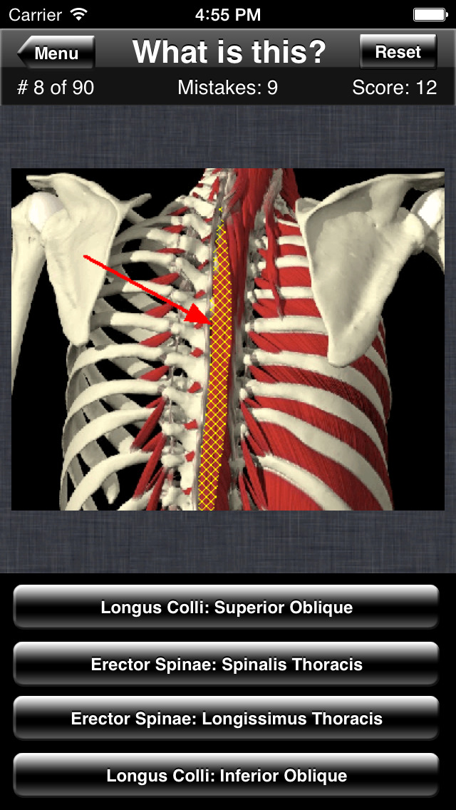 Anatomy Spine Quiz screenshot1