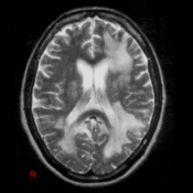 neurology figures