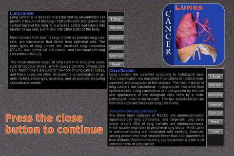 Lungs Cancer II screenshot 4