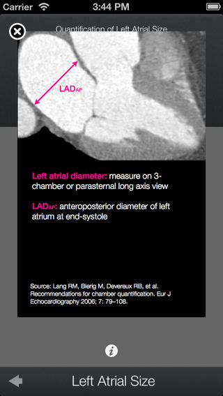 免費下載音樂APP|Thoracic CT Toolkit app開箱文|APP開箱王