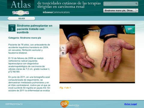 【免費醫療App】Atlas de Toxicidades Cutáneas de las terapias dirigidas en carcinoma renal-APP點子