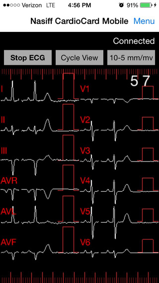 【免費醫療App】CardioCard Mobile-APP點子