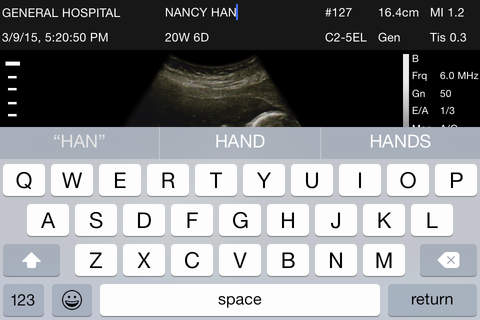 Mom, I'm pregnant - Ultrasound Prank Lite screenshot 3