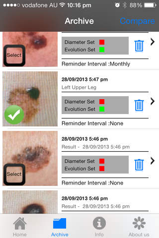 Doctor Mole Lite - Skin Cancer App screenshot 4