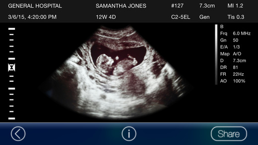 Ultrasound Pregnancy Prank Lite