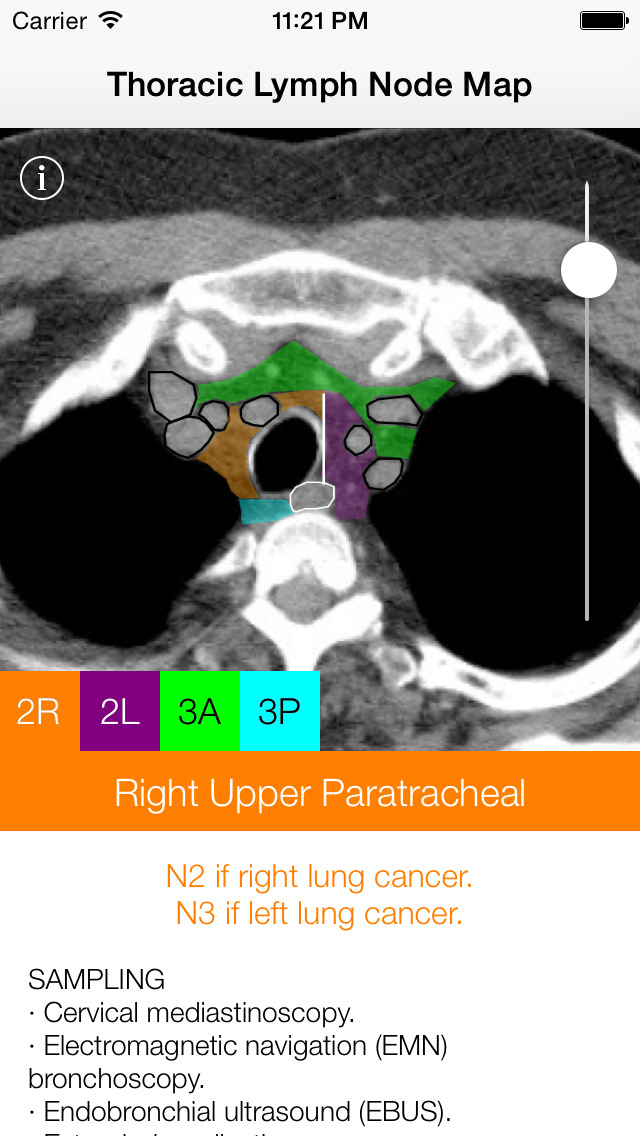 App Shopper: Thoracic Lymph Node Map for iPad & iPhone (Medical)