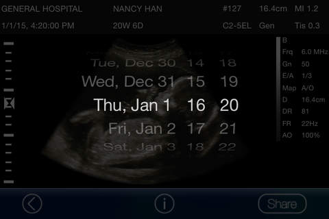 Mom, I'm pregnant - Ultrasound Prank Lite screenshot 4