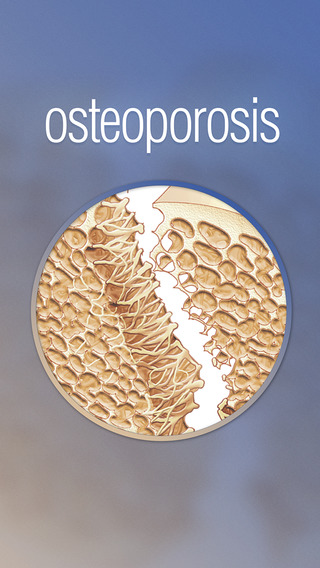 Miniatlas Osteoporosis
