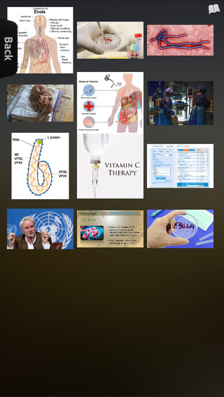 免費下載醫療APP|Ebola Disease app開箱文|APP開箱王