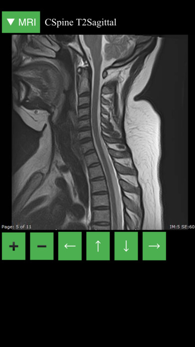 MRI Viewer screenshot 3