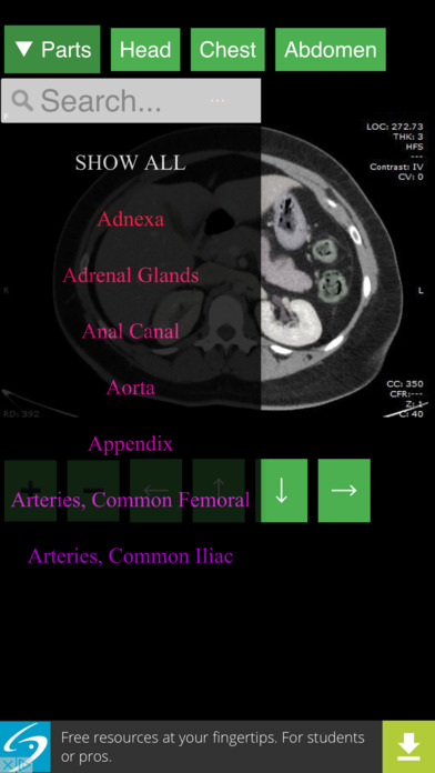 Anatomy on Radiology CT screenshot 3