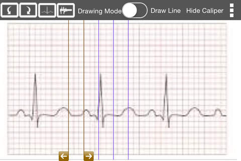 ECG Analyser screenshot 2