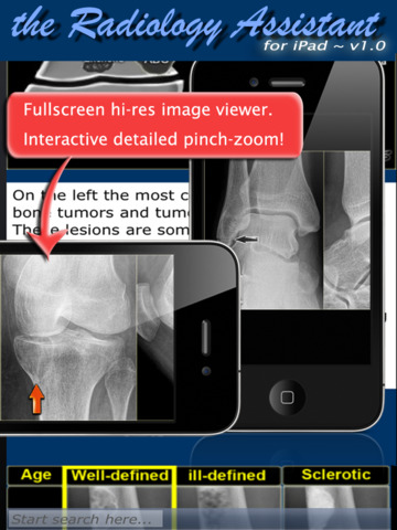 Radiology Assistant for iPad - Imaging Reference screenshot 4
