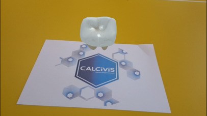 CALCIVIS imaging system screenshot 2