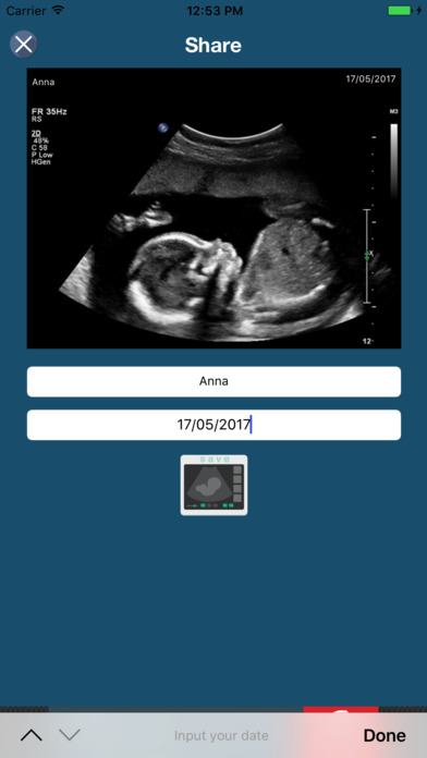 Baby Ultrasound - Prank Ultrasound Spoof screenshot 2