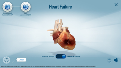 HeartMate 3™ LVAD AR app screenshot 2