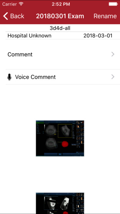 MedSight Dicom screenshot 2