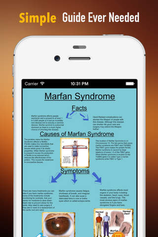 Marfan Syndrome:Guide with Glossary and Top News screenshot 2