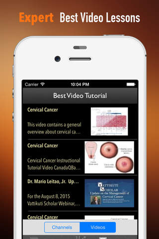 Cervical Cancer Prevention:Tips and Tutorial screenshot 3