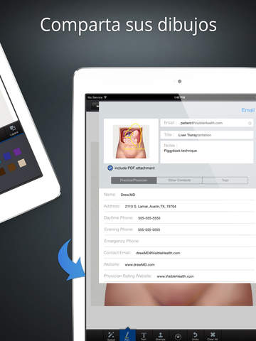drawMD Transplant Surgery screenshot 3