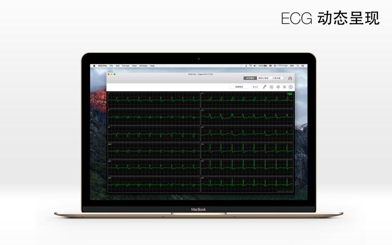 ECG Cases screenshot 2