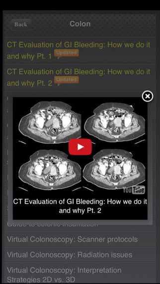 【免費醫療App】CTisus iLecture Series-APP點子