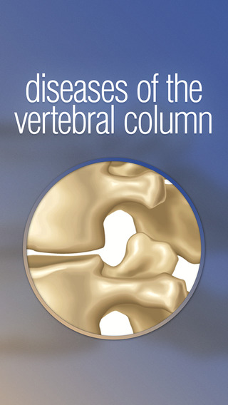Miniatlas Diseases of the vertebral column