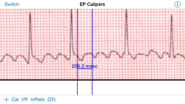 EP Calipers