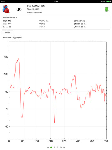 【免費健康App】HeartBeat Visualisation-APP點子