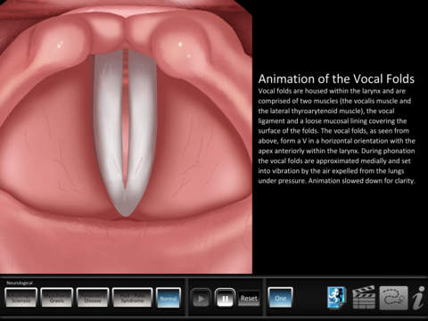 【免費教育App】Vocal Pathology: Neurological-APP點子