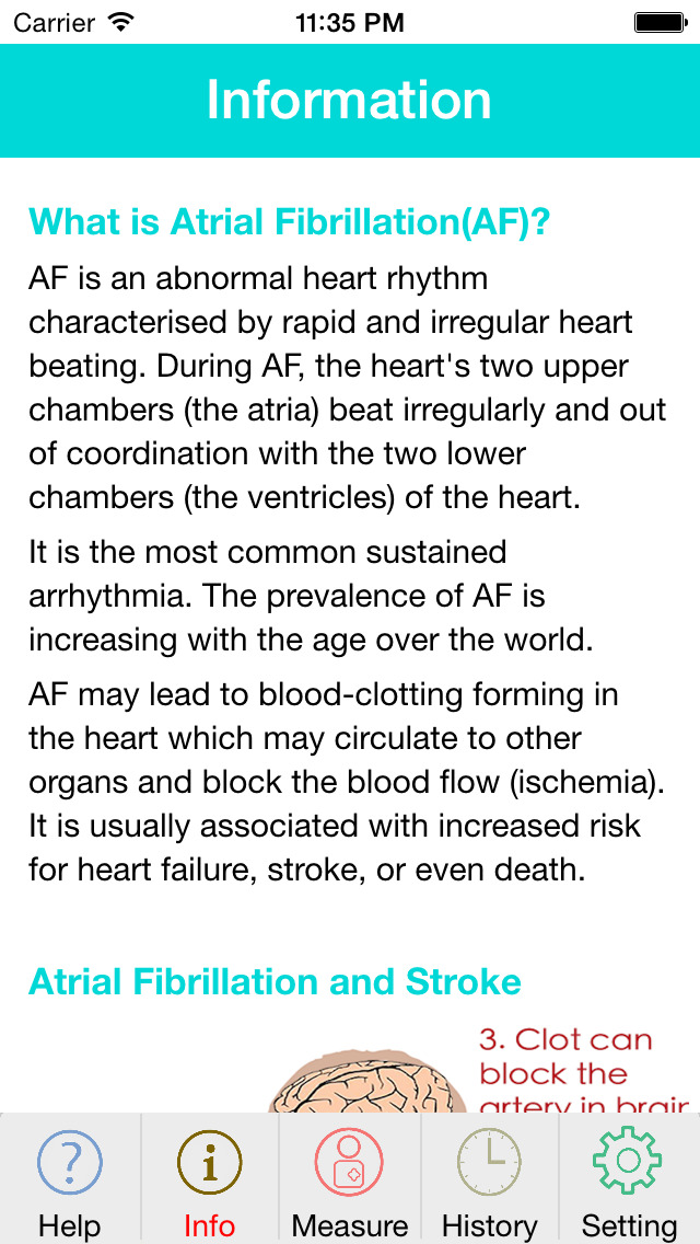 Photo AFib Detector Apps 148Apps