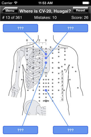 Acupuncture Points Body Quiz - náhled