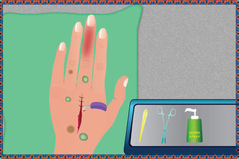 Hand Surgery - Free doctor surgeon and medical car - náhled